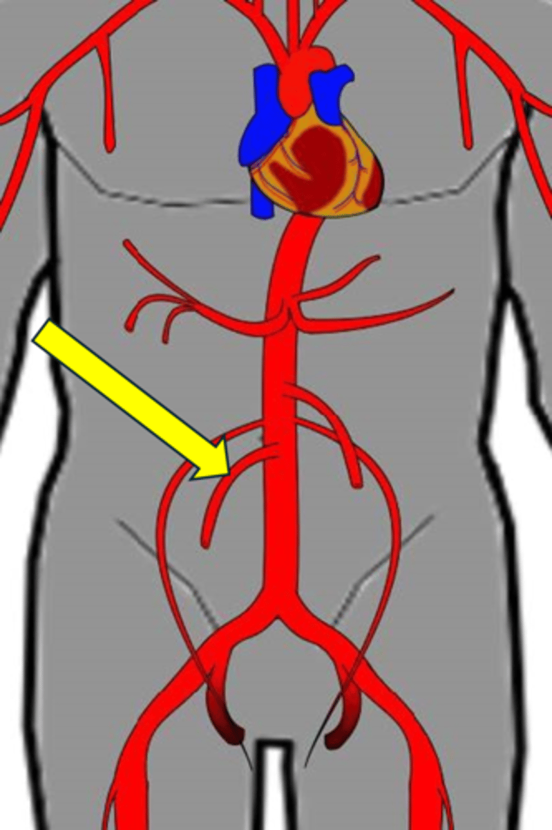 <p>Name the red vessel.</p>