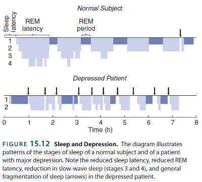 <p>&nbsp;</p><p class="MsoNormal">Sleep pattarns are desturbed</p><p class="MsoNormal">Tome of night and stage of sleep</p><p class="MsoNormal">Go to rem sleep to soon more intupted sleep poor slow wave sleep</p><p class="MsoNormal">&nbsp;fall aslep faster </p><p class="MsoNormal">distoerbed sleep </p><p class="MsoNormal">low levels of slow wave sleep </p><p class="MsoNormal">•<span style="font-size: 7pt; font-family: &quot;Times New Roman&quot;">&nbsp;&nbsp;&nbsp;&nbsp;&nbsp;&nbsp;&nbsp; </span>REM sleep is entered too early</p><p class="MsoNormal">•<span style="font-size: 7pt; font-family: &quot;Times New Roman&quot;">&nbsp;&nbsp;&nbsp;&nbsp;&nbsp;&nbsp;&nbsp; </span>REM sleep deprivation has long-term effects</p><p class="MsoNormal">•<span style="font-size: 7pt; font-family: &quot;Times New Roman&quot;">&nbsp;&nbsp;&nbsp;&nbsp;&nbsp;&nbsp;&nbsp; </span>Many anti-depressants (but not all) suppress REM sleep</p><p class="MsoNormal">&nbsp;</p>
