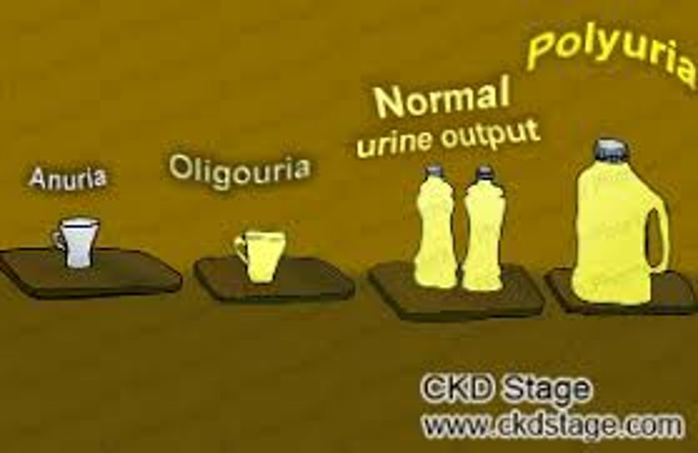 <p>(ol-i-GYOOR-ee-uh) Scanty or insufficient urination (ការនោមតិចជាងធម្មតា)</p>
