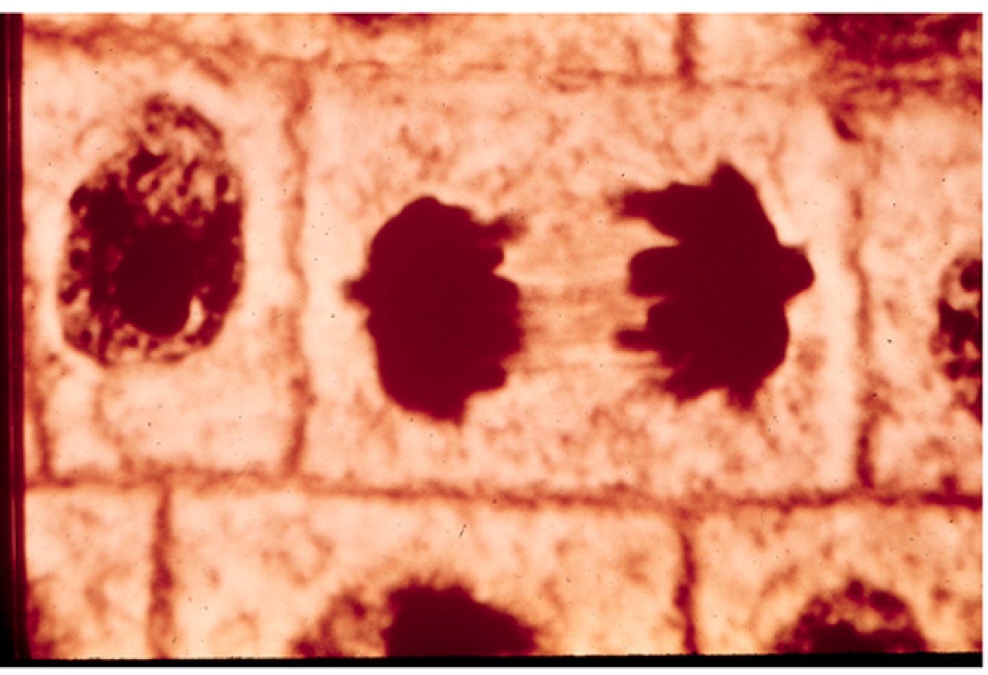 <p>This shows ________ in onion cells.</p>