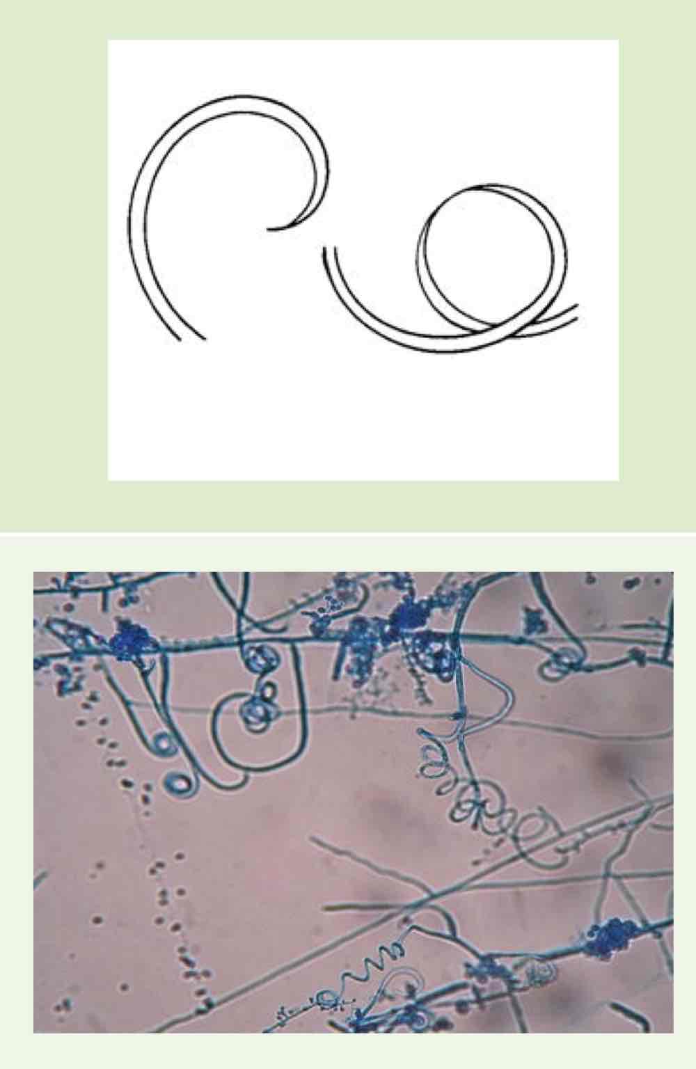 <p>Name this hyphae</p>