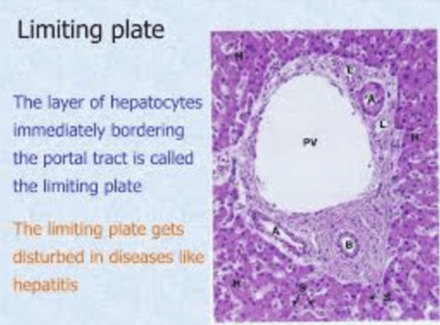 <p>Limiting Plate: </p><p>cylindrical plate made up of modified hepatocytes, which surround the portal triads and have specialized roles related to them. (they are like the border of portal triads)</p><p>Hepatocyte plates are rows of liver cells metabolising, detoxifying, and producing bile.</p>