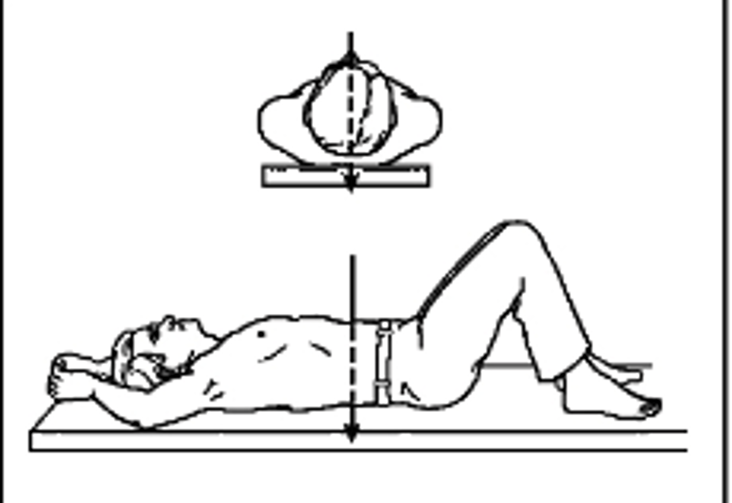 <p>What type of projection is this?</p><p>a. Posteroanterior</p><p>b. Anteroposterior</p><p>c. Left Lateral</p><p>d. AP oblique</p>