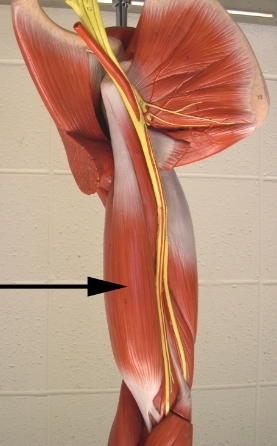 <p>Name the proximal attachment of the muscle indicated by the arrow</p><p>VIEW: anterior side of the brachial region (the upper limb)</p>