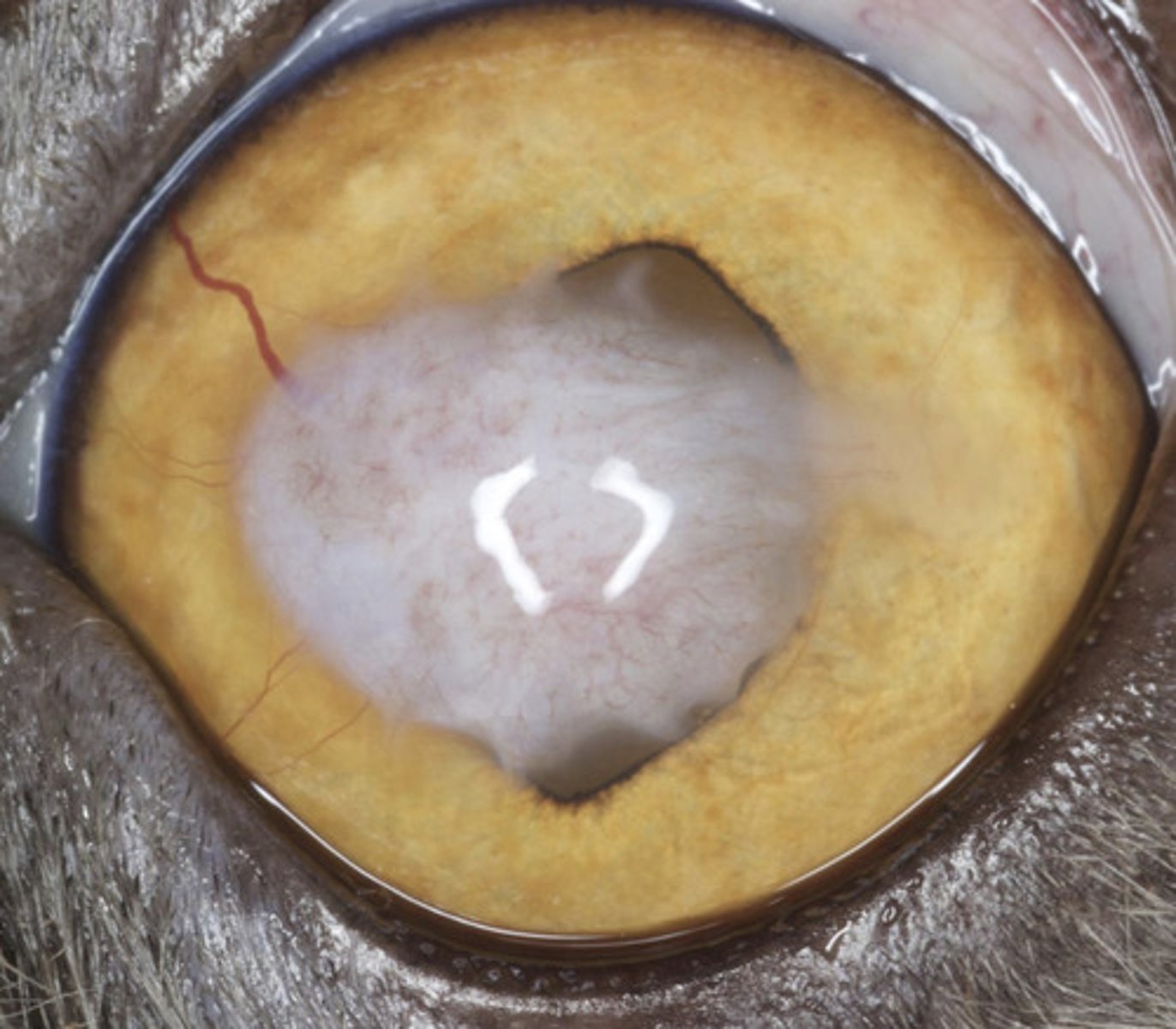 <p>What am I describing?</p><p>- White opacities</p><p>- Increased and/or disorganized collagen</p><p>- Historical keratitis</p><p>- Often associated with vascularization</p><p>- Non-painful</p><p>- No treatment</p>