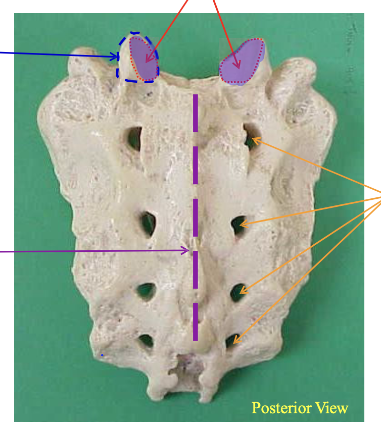 <p>Name the structure highlighted in blue (NOT the full protrustions)</p>