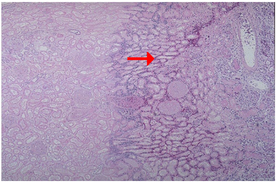 <ol><li><p>Identify the type of cell death and CD</p></li><li><p>What zone is the arrow pointing at?</p></li></ol><p></p>