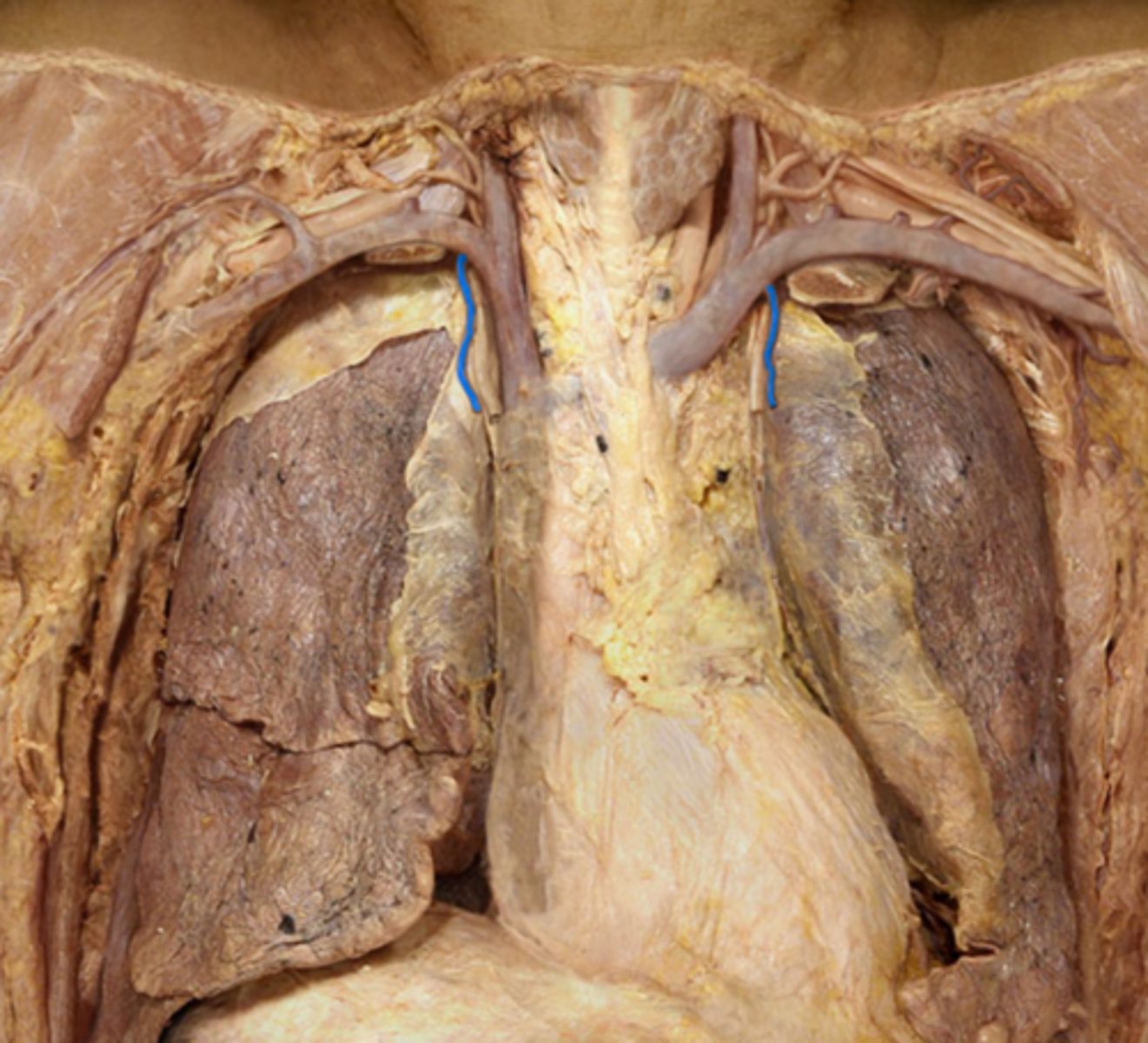 <p>Name the Vein</p>