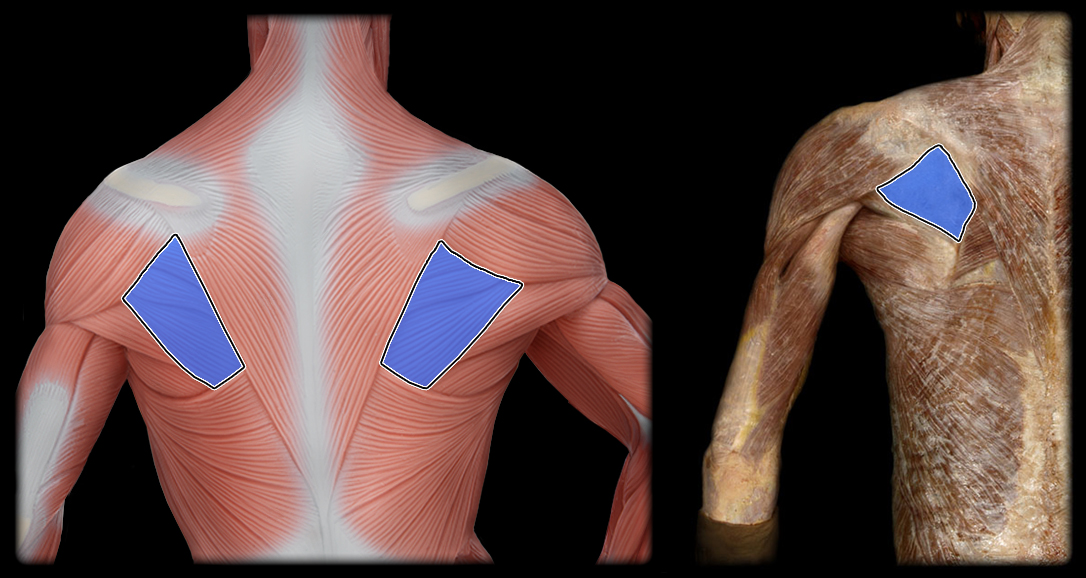 <p>insertion of the infraspinatus</p>