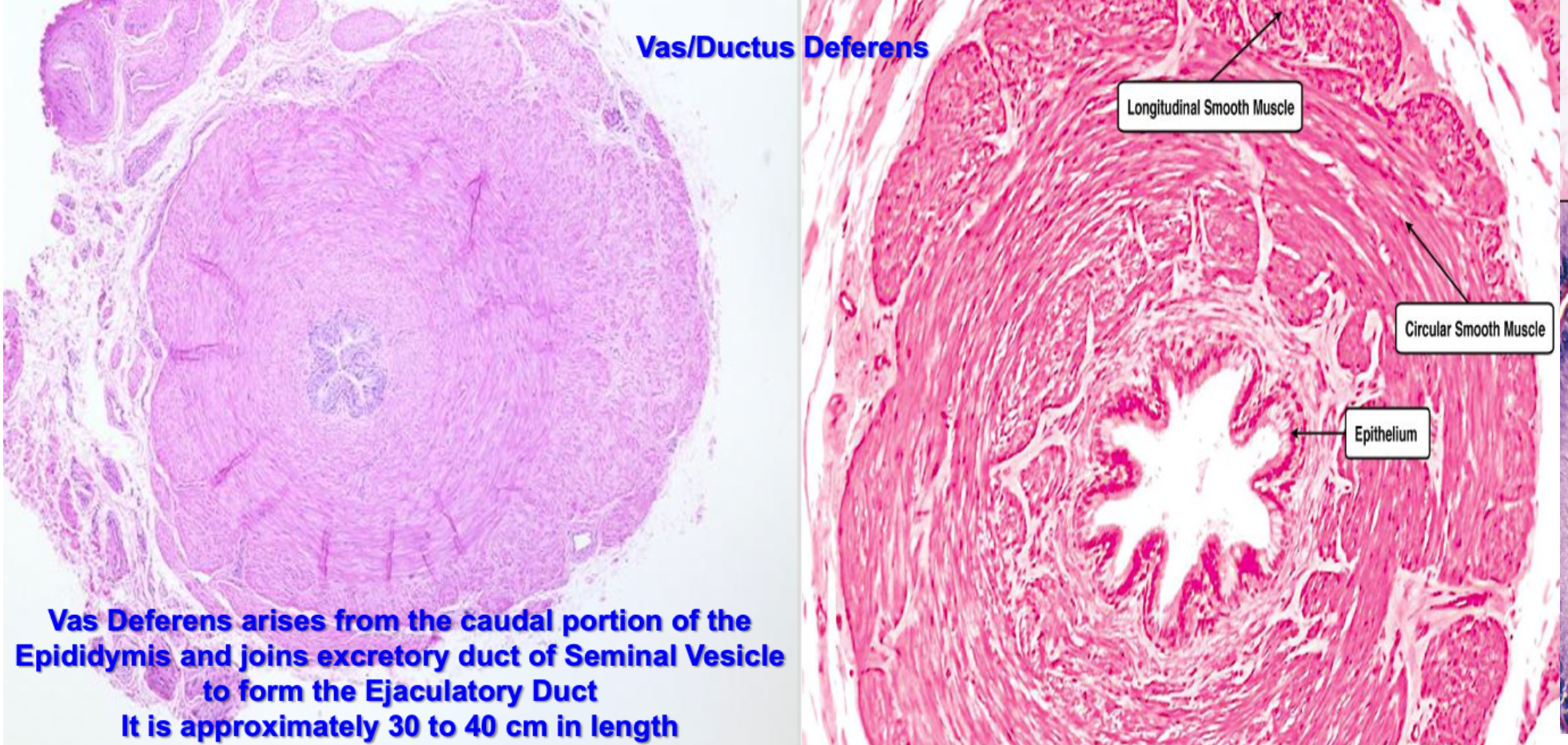 <p>The vas (ductus) deferens</p>