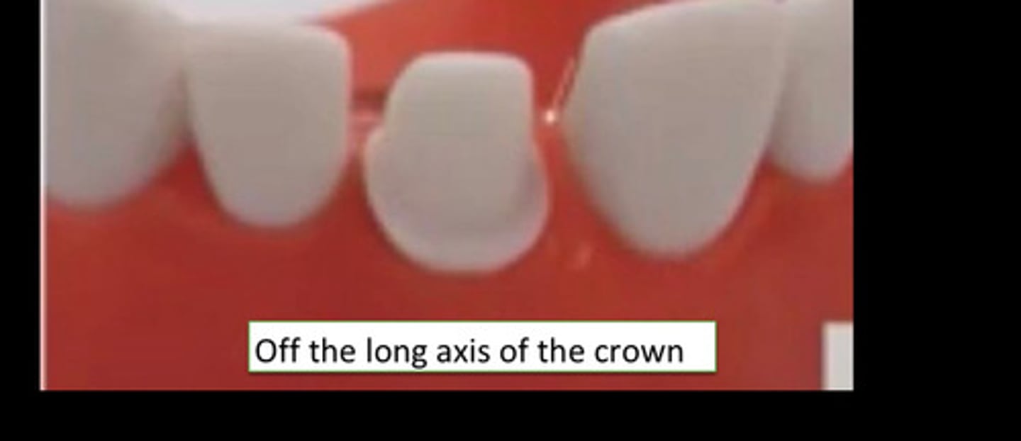 <p>A common error is</p>