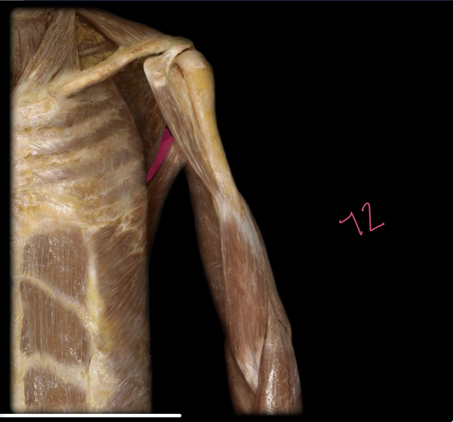 <p>Teres major</p>