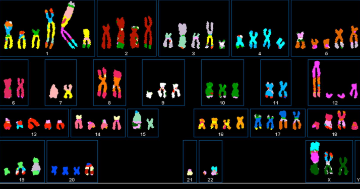 Derived from breast cancer 
- Hypertriploid
- 37 structural abnormalities involving all chromosomes except 6 and 16
- And more...