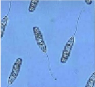 <p>What is this (1/4 classification of protozoans)</p>