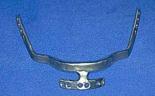 <p>What is a Ramus Frame Implant?</p>