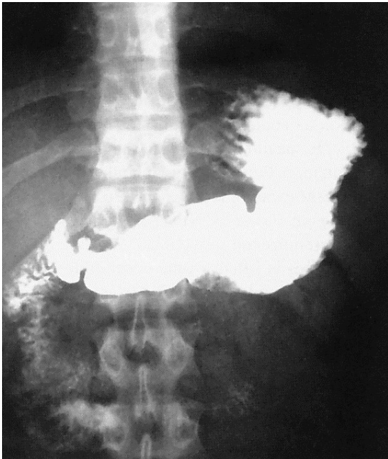 <p>What contrast procedure was performed to produce this image?</p>