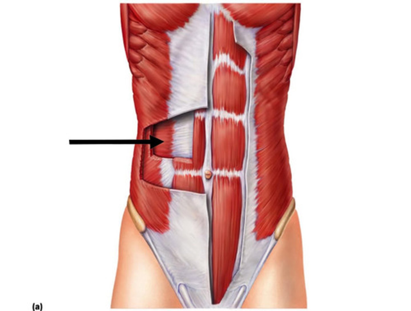 <p><strong>Origin</strong>: Anterior iliac crest, lateral half of inguinal ligament, thoracolumbar fascia and cartilages of ribs 6-12</p><p><strong>Insertion</strong>: Abdominal aponeurosis to linea alba, xiphoid process and pubic symphysis</p><p><strong>Action</strong>: compresses abdomen</p>