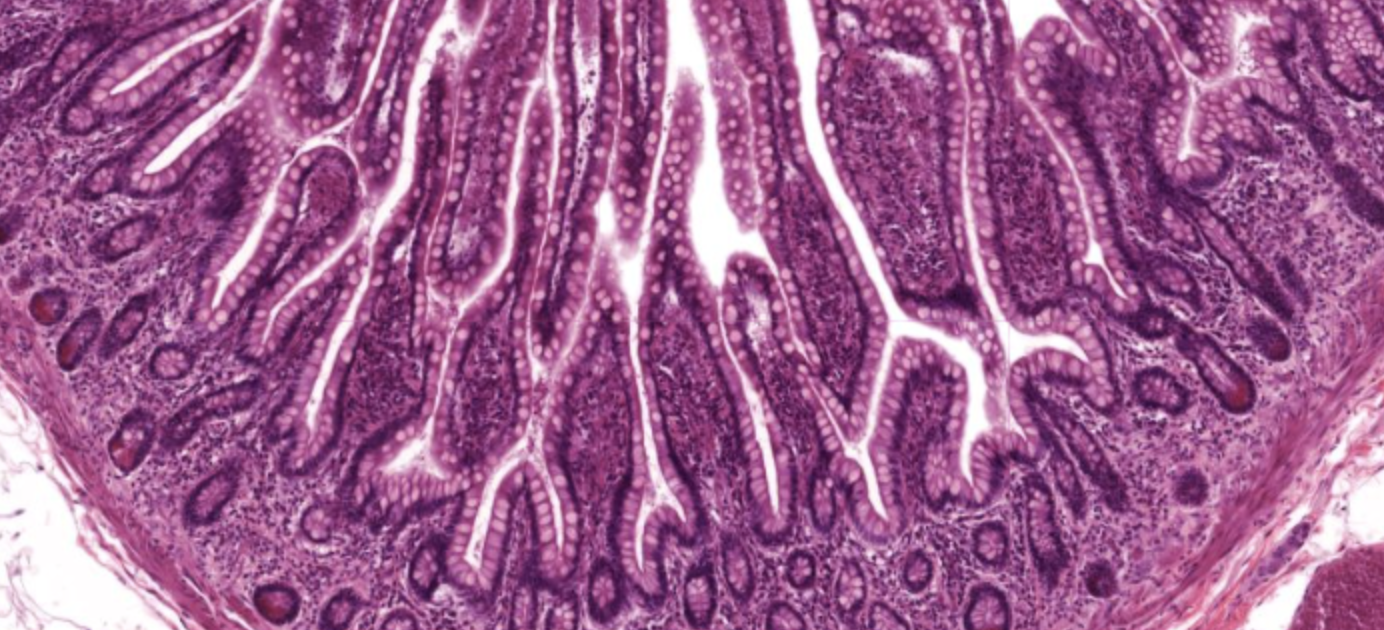 <p>Mucosa in Ileum</p>