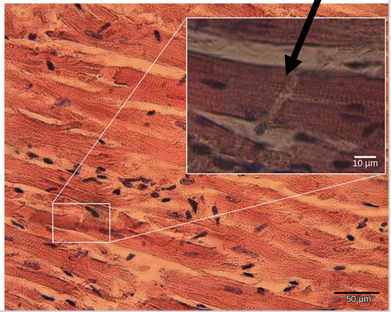 <p>Cardiac Muscle</p><p>Striated, Single Nucleus, and Involuntary&nbsp;</p><p>Found in: walls of heart ONLY </p><p>have intercalated discs : attach cells together </p>