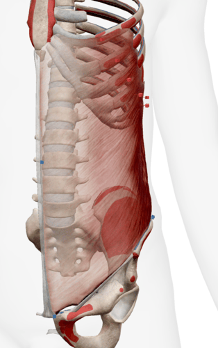 <p>iliac crest and linea alba</p>