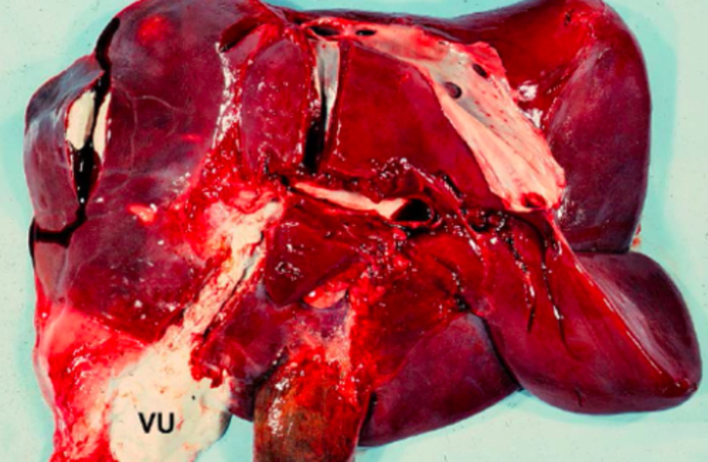 <p>Lever fra kvæg, hvad er den patoanatomiske diagnose?</p>