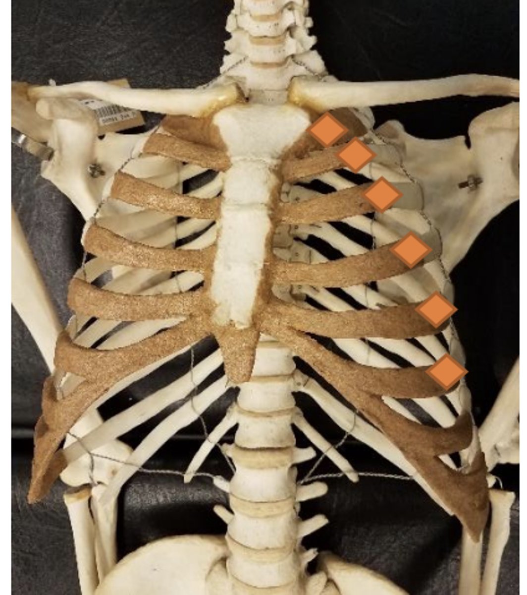 <p>on affected rib at anterior axillary line</p>