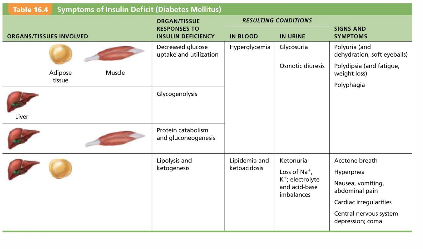 <ul><li><p>cardinal signs of DM</p><ol><li><p>Polyuria—huge urine output</p></li></ol><ul><li><p>Glucose acts as osmotic diuretic</p></li></ul><ol start="2"><li><p>Polydipsia—excessive thirst</p></li></ol><ul><li><p>From water loss due to polyuria</p></li></ul><ol start="3"><li><p>Polyphagia—excessive hunger and food&nbsp;<span style="background-color: transparent; font-size: 1.6rem;"><span>consumption</span></span></p></li></ol><ul><li><p>Cells cannot take up glucose; are "starving"</p></li></ul></li></ul><p></p>