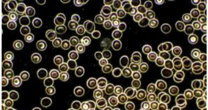 <p><span style="background-color: transparent;"><span>Darkfield illumination </span></span></p>