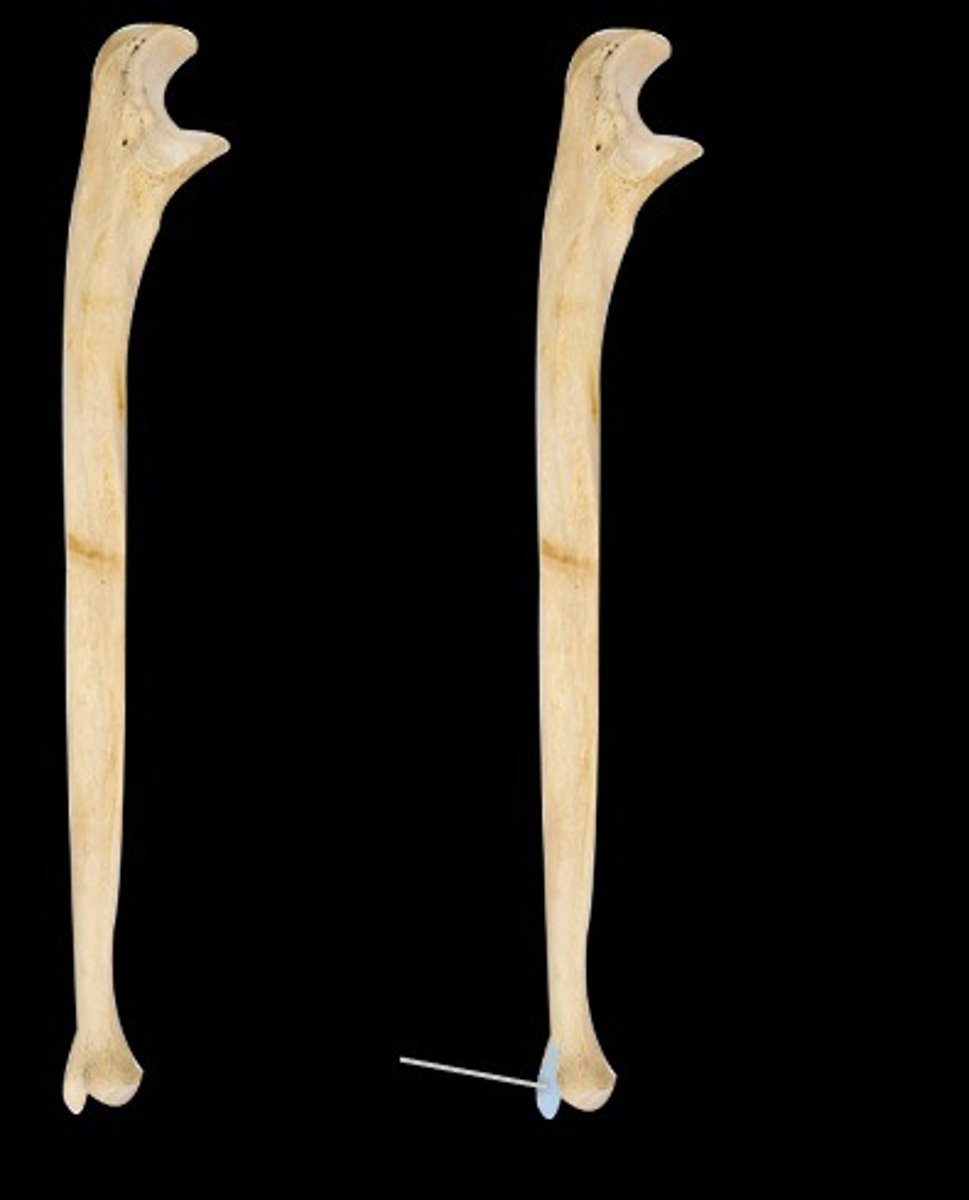 <p>sharp, distal-most projection on the posteromedial corner</p>