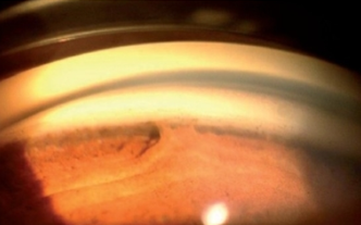 <p>identify </p>