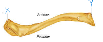<p>label X and Y; which clavicle is this? which view is this? </p>