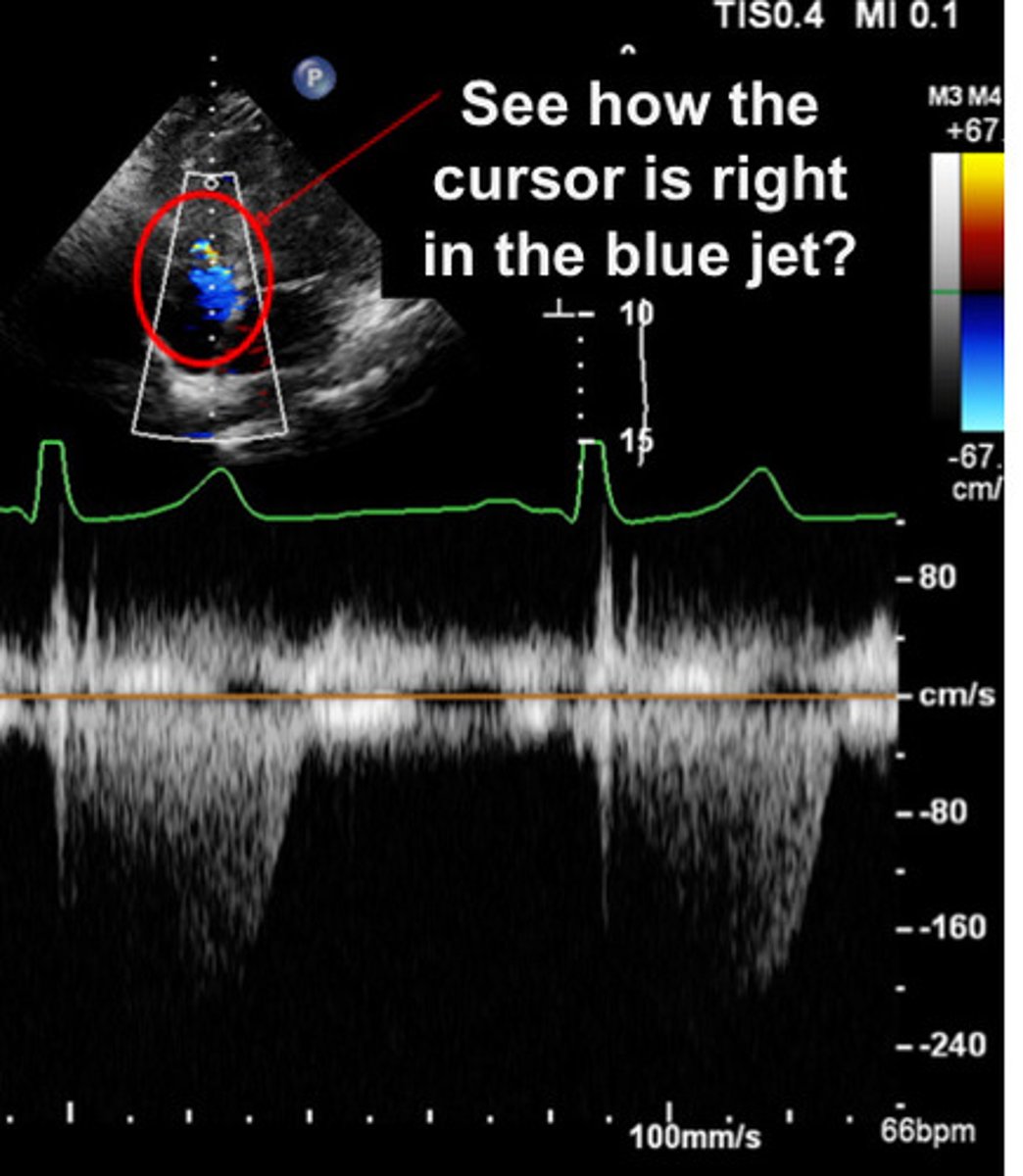 <p>Would you measure this TR jet</p>