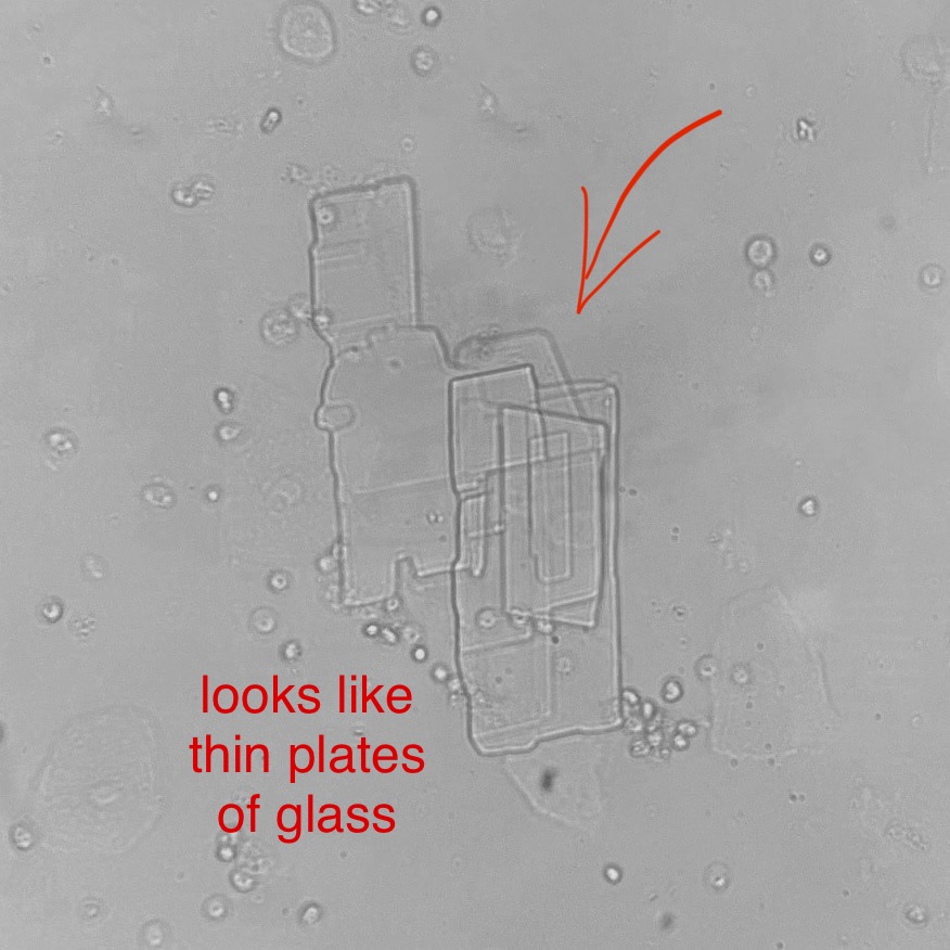 <p>What do you see in this image?</p><p>Is it clinically significant?</p><p>Acidic or Alkaline?</p><p>What can it indicate?</p>