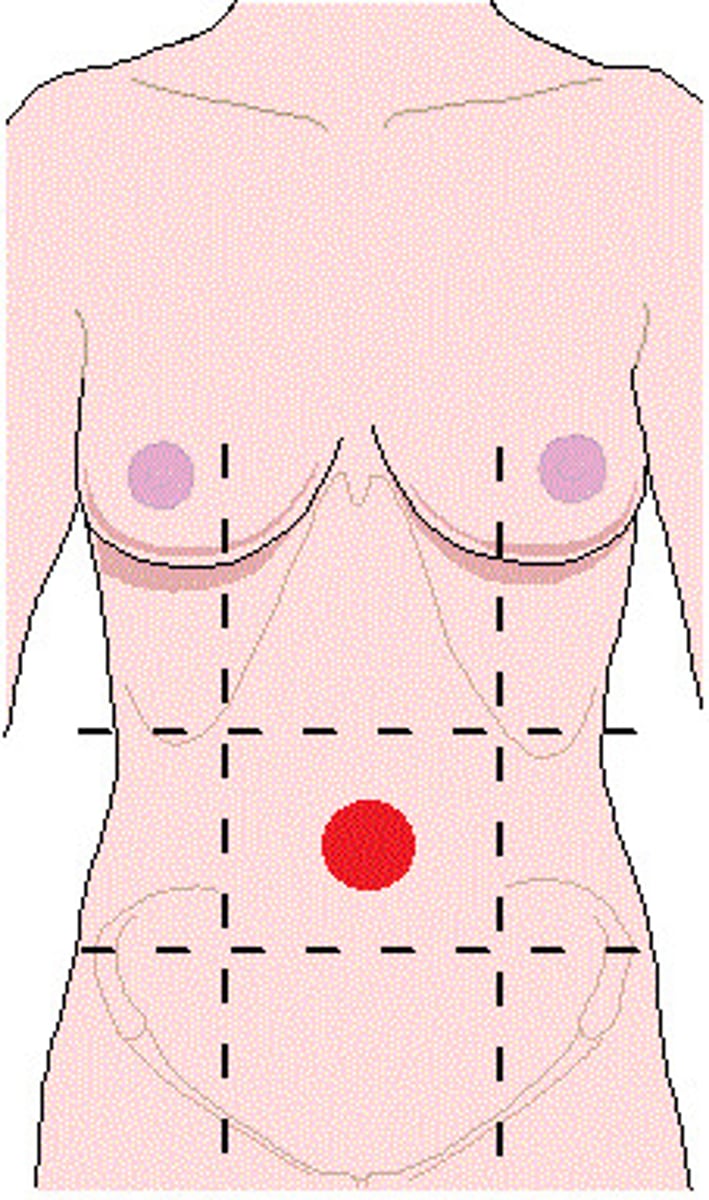 <p>Location:</p><p>Abdominal wall (anterior)</p><p>Description:</p><p>One of nine regions of abdominal cavity</p><p>Median region (flanked by right and left flank regions)</p><p>Contents include parts of small and large intestines</p>
