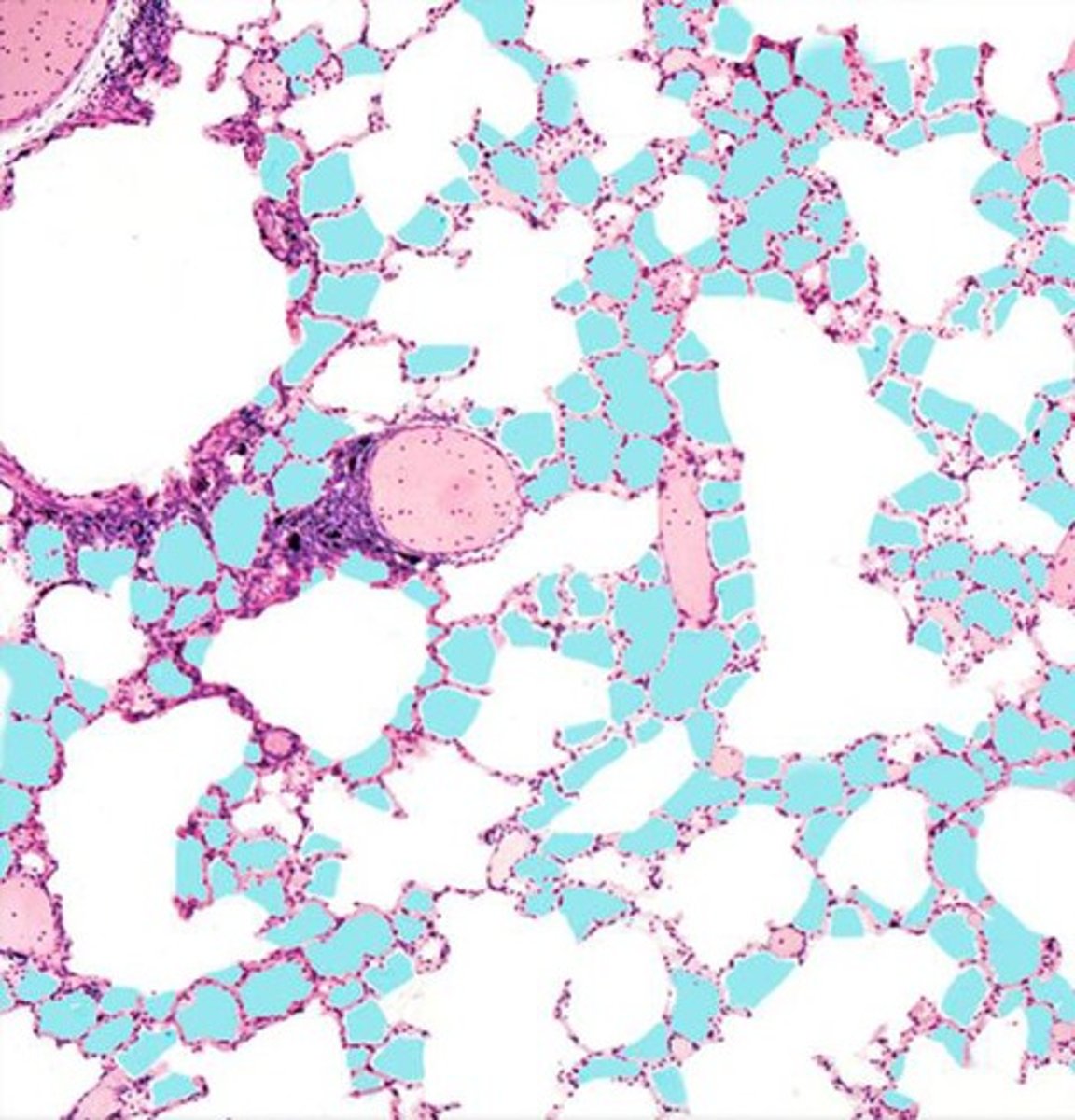 <p>Identify these sac-like respiratory structures highlighted in blue.</p>