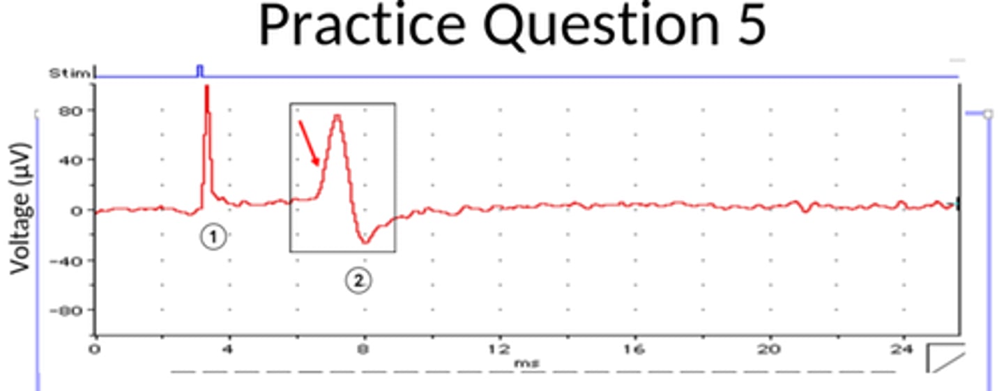 <p>The charge at the positive recording electrode is more negative compared to the negative recording electrode</p>