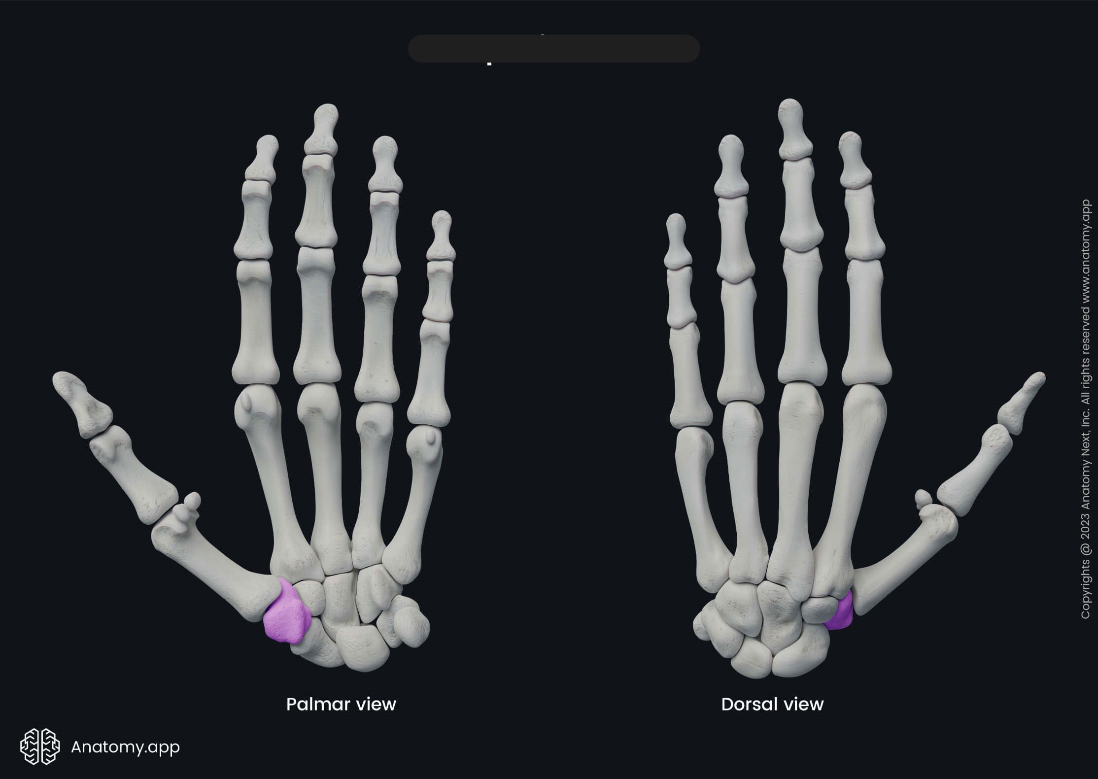 <p>What bone is this?</p>