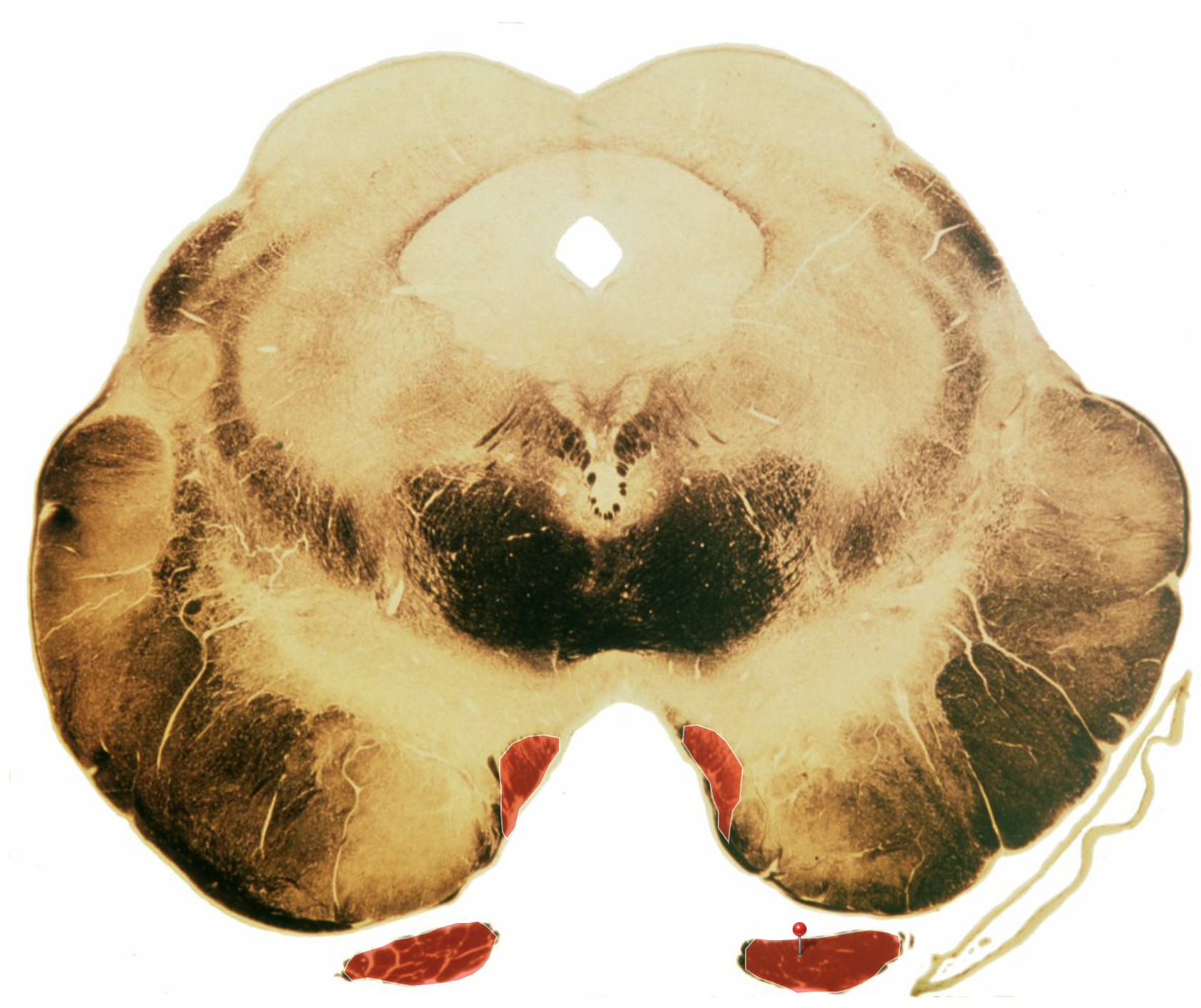 <p>What is this structure, what level of the brainstem is this on?</p>