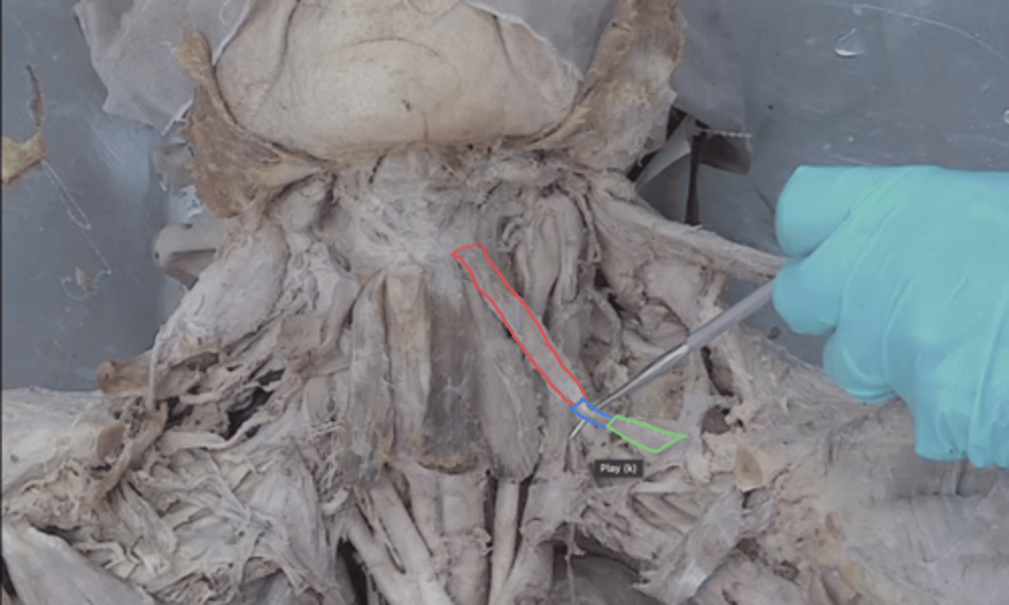 <p>identify this muscle in green</p>