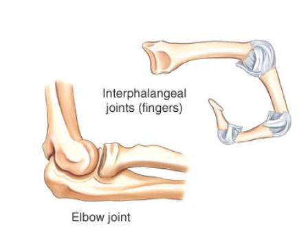 <p>hinge that allows for flexion and extension</p><ul><li><p>ex: interphalangeal/elbow joint</p></li></ul><p></p>