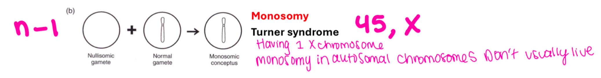 <p>A chromosomal condition where an individual has only one copy of a chromosome instead of two.</p><p>Autosomal monosomy is lethal and nearly always is incompatible with survival to term</p><p>Sex chromosome aneupoloidy</p><p>Turner syndrome 45, X (2n-1)</p><p></p>