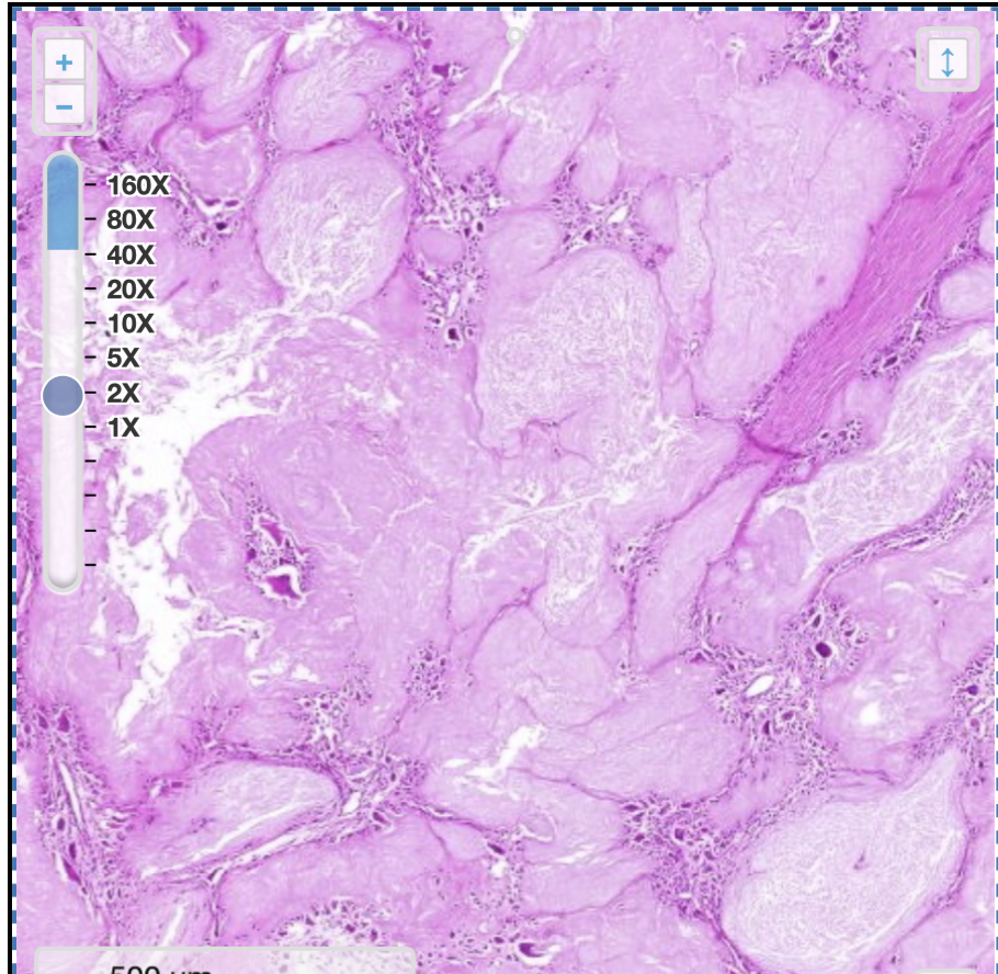 <p>jichtophus: wat zie je op deze uitvergroting</p>