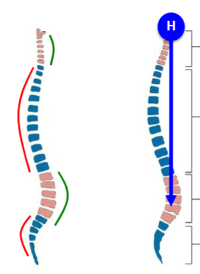 <p>Project backwards (thoracic and sacral) - red</p>