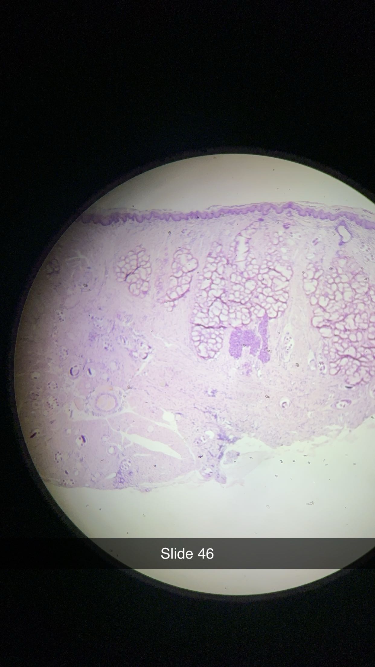 <p>genus, phylum, illness  </p>