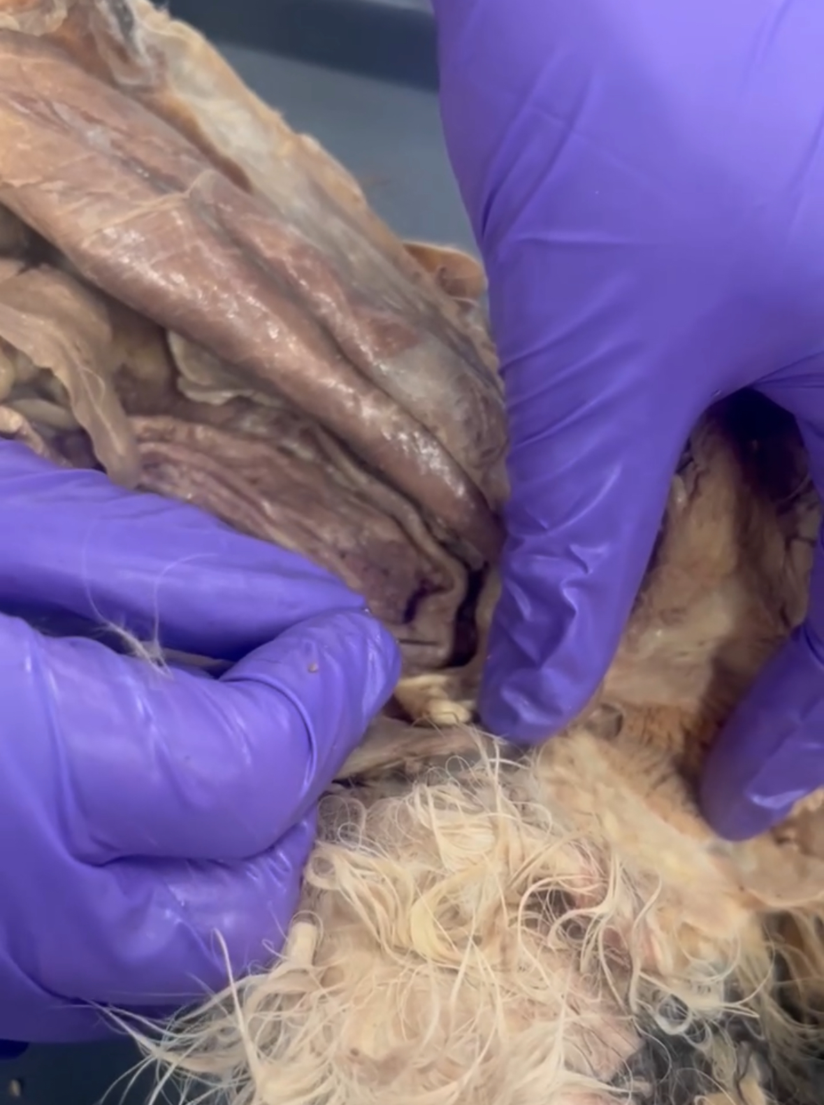 <p>Where Uterine Horns meet</p>