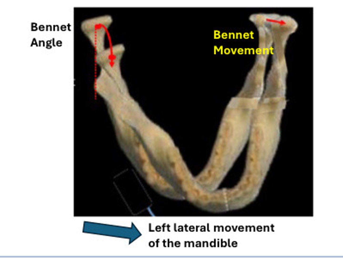 <p>Contacts of</p><p>teeth made on the side of the occlusion</p><p>toward which the mandible has been</p><p>moved. (In this image left side contacts)</p>