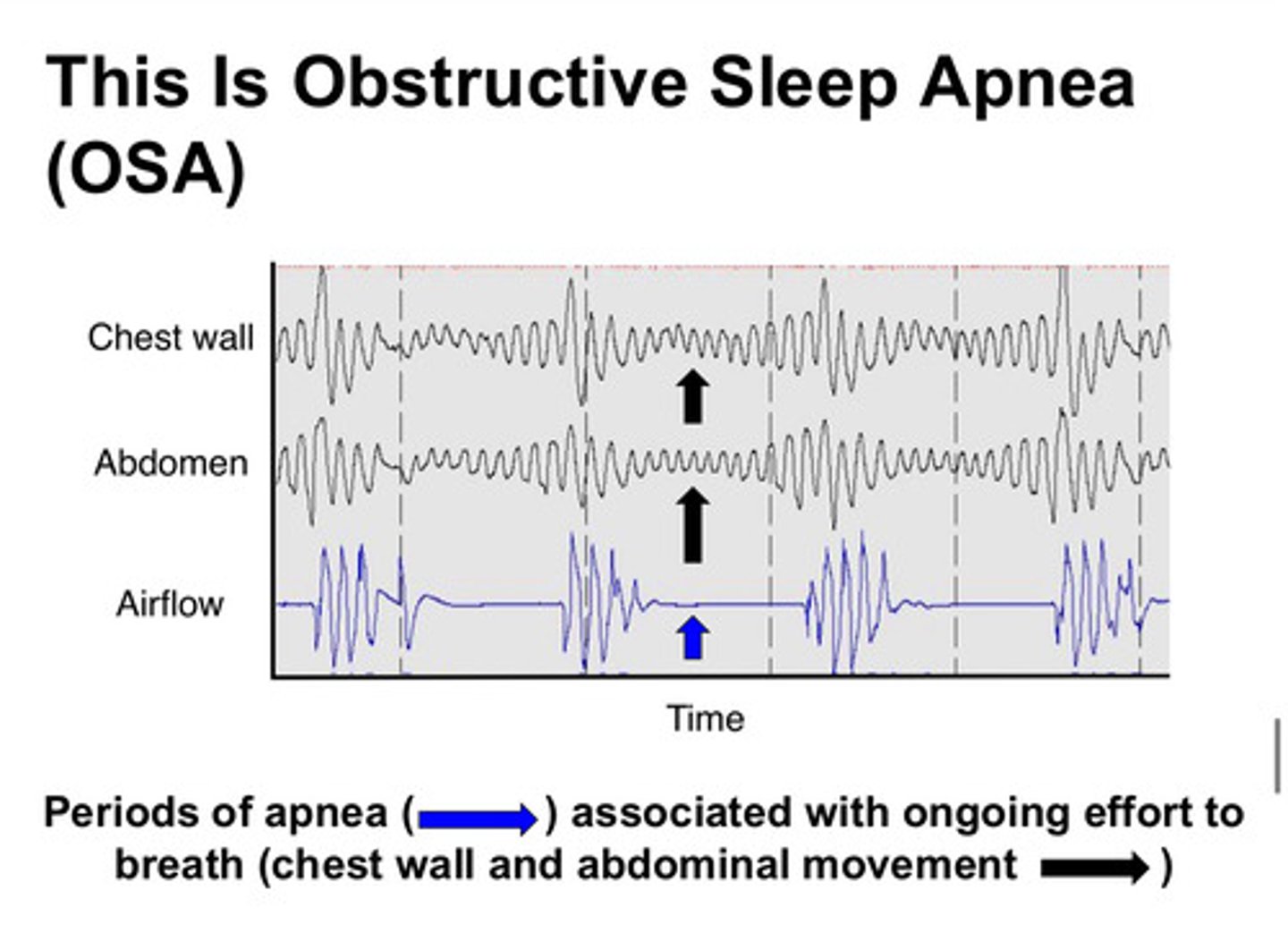 <p>in OSA, there is a problem (obstruction) in the pathway of the air into/out of the lungs. these patients will have episodes of no airflow in or out of the lungs, but they continue to have chest wall/abdominal movements as they attempt to breathe</p>