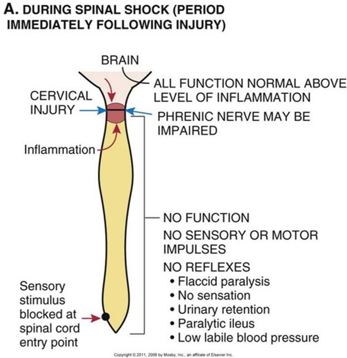 <p>total loss of reflexes below level of lesion</p><p>- flaccid paralysis, sensory deficit, loss of bladder + rectal control, drop in BP, disturbed temperature</p><p>- days up to 3 months</p><p>- results in poor venous circulation</p>