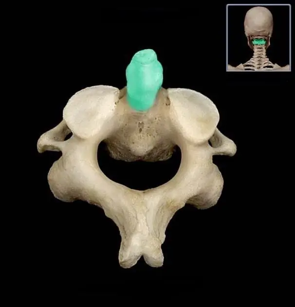 <p>What structure of the vertebra is this?</p>