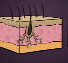 <p>Root-(hair)</p>